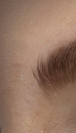 PS CC 2015.1（拡散 2）で修復