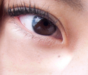 패치 도구를 사용하여 PS CC 2014에서 왼쪽 눈의 아래 복구